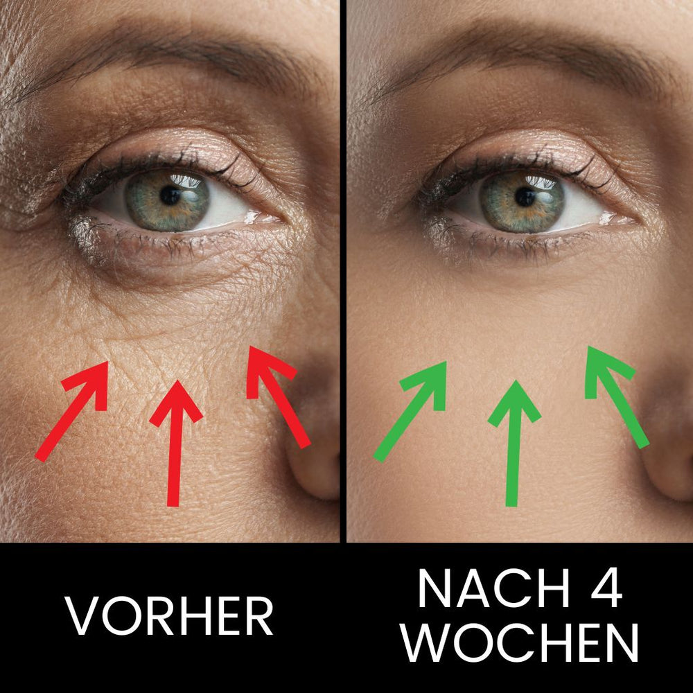 Black Hydrogel Eye Patches with Ginseng